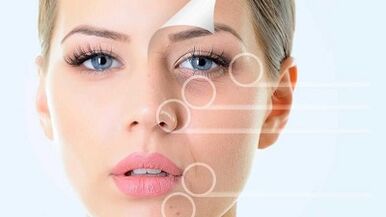 Rajeunissement du visage